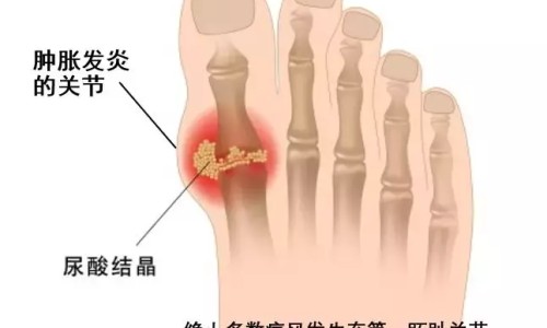 人流后吃羊汤好吗-做流产手术可以吃羊肉吗专区_流产后可以吃羊肉么补身体专区_女人人流术后吃羊肉好不好网